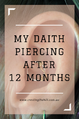 my daith piercing update - 12 months post-piercing