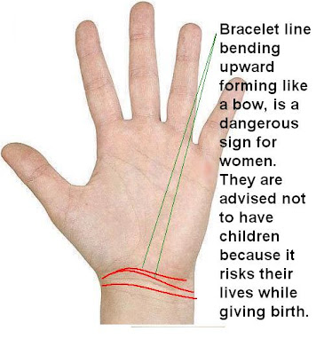 The probability increases when the second bracelet line too form like ...