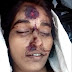 युवती का मिला शव,पुलिस ने परिजनों को बिना सूचना दिए भेजा पोस्टमार्टम 