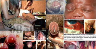 Obat Anti Virus/Bakteri Kencing Nanah Gonorrhea Yang Alami