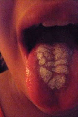 Bizarre Piercing And Tongue Tattooing