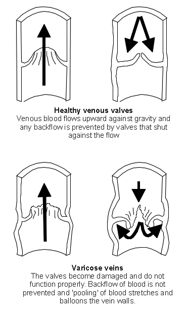 V+V+Diagram.JPG