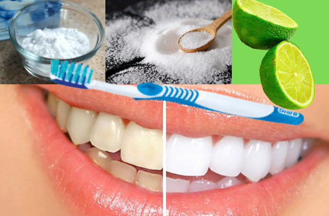 Blanqueamiento dental natural: cómo lograr dientes más blancos con  ingredientes caseros