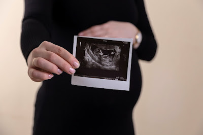 Pregnant woman holding ultrasound (Credit: Volodymyr Hryshchenko/Unsplash)