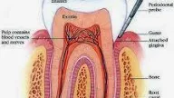 Tips Agar Gigi tidak Cepat Rusak
