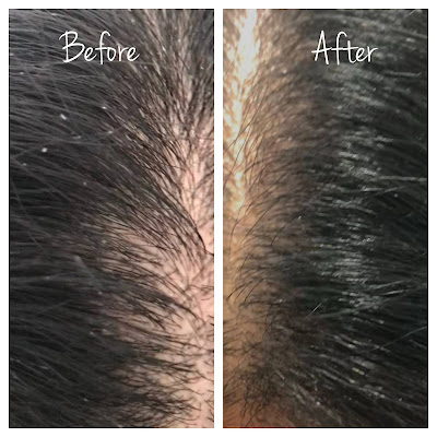 Scalp before and after