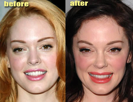 12 Weirdiest Plastic Surgery Makeovers