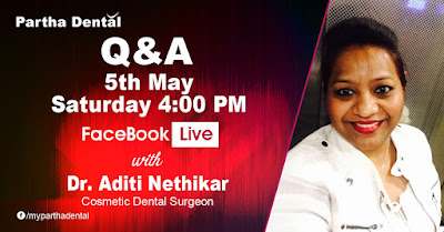 Partha Dental Facebook Live with Dr.Aditi Nethikar