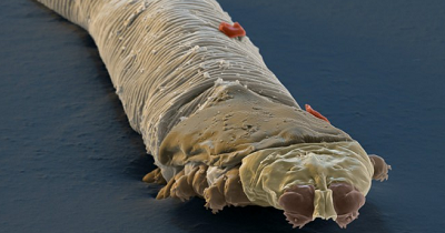 Kutu demodex di wajah dan folikel rambut