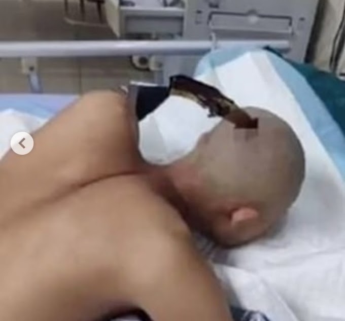 Video shows man walking calmly to an ambulance with a knife stuck in his skull