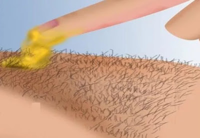 Astounding TIP! Investigate HOW TO PERMANENTLY TAKE OFF HAIR FROM YOUR LADY PARTS IN AN ALL-NATURAL WAY JUST BY APPLYING THIS HOMEMADE MIXTURE 