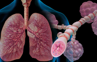Penyakit dan Kelainan Pada Paru-Paru Manusia