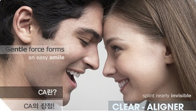 Niềng răng trong suốt Clear Aligner có hiệu quả không?