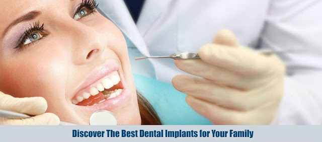 Discover The Best Dental Implants for Your Family
