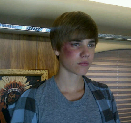 justin bieber . justin bieber stabbed