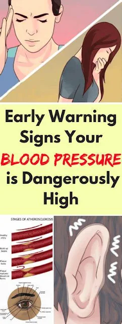 Early Warning Signs Your Blood Pressure is Dangerously High (1 in 5 don’t know they have it!)