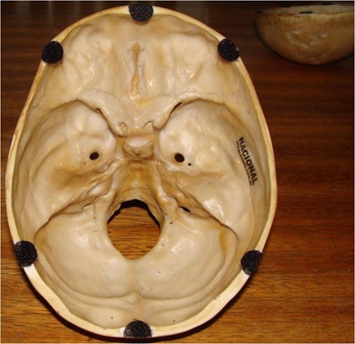 cranionac3