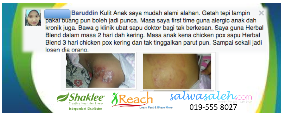 Testimoni Herbal Blend Multi-Purpose Cream Shaklee 