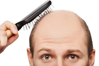 دراسات طبية حديثة ضد تساقط الشعر