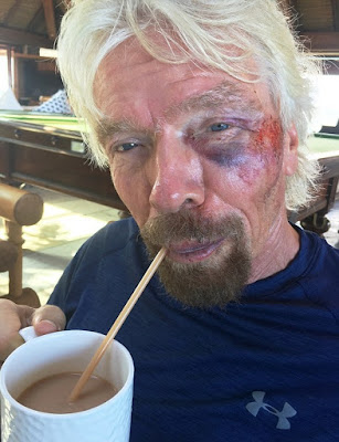 Richard Branson In Bike Accident 2016
