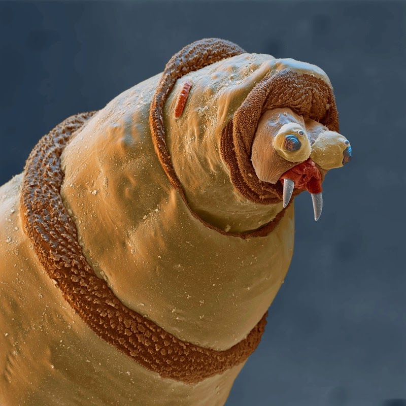 16 Terryfying Images From The Microscope - Maggot