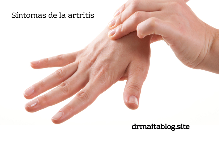 Sintomas de la artritis