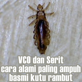 Cara alami paling ampuh basmi kutu rambut