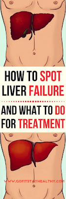 Detox Your Liver: Try My 6-Step Liver Cleanse