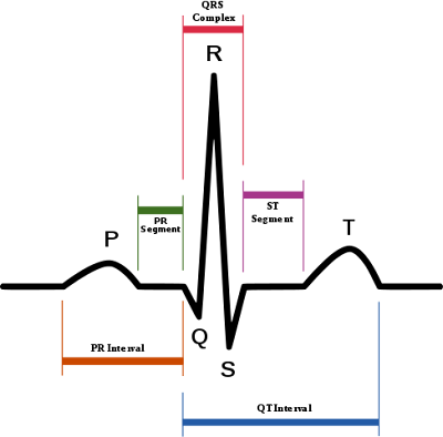 Diagram of normal sinus rhythm ECG