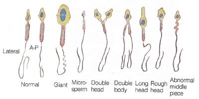 anatomi sperma