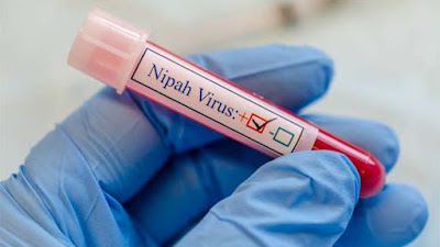 Tewaskan 2 Warga India, Begini Gejala Virus Nipah yang Mirip COVID-19