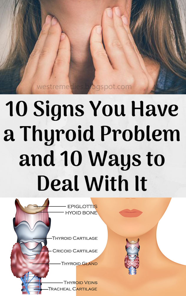 10 Signs You Have a Thyroid Problem and 10 Ways to Deal With It ...