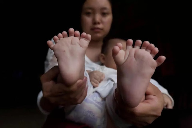 Chinese baby boy is born with 15 fingers, 16 toes