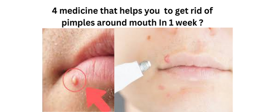 how to get rid of pimples around mouth In 1 week ?