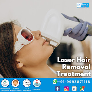 Laser Hair Removal