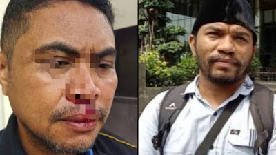 Polresta Kupang Diminta Tangkap Buron Pelaku dan Aktor Intelektual Percobaan Pembunuhan Wartawan di Kupang