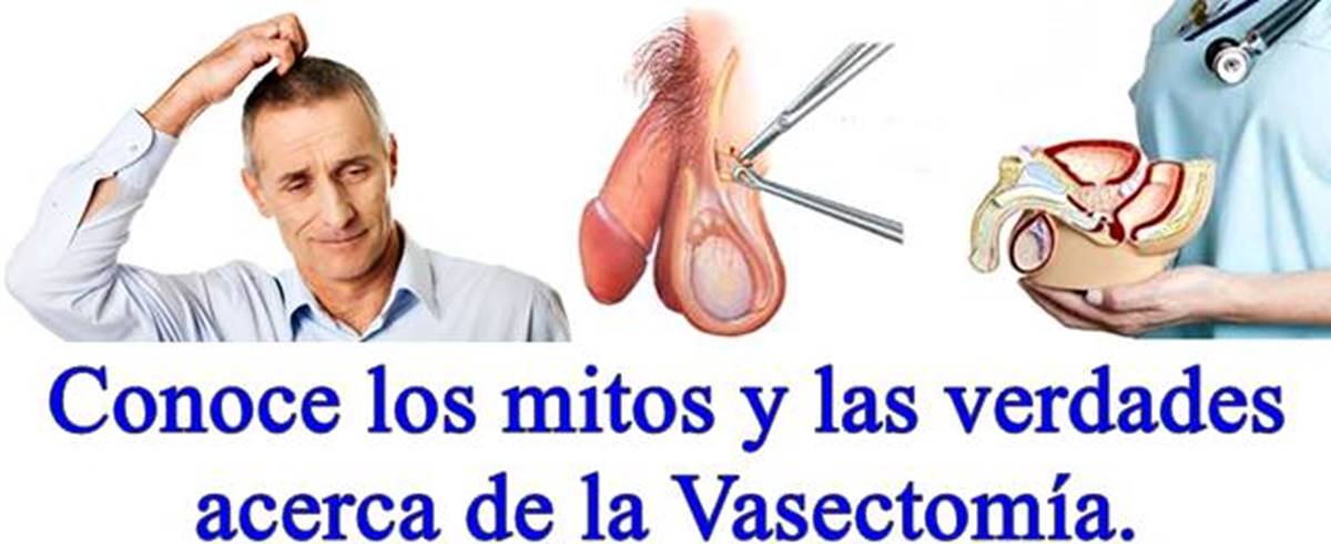 Mitos y verdades sobre la Vasectomía