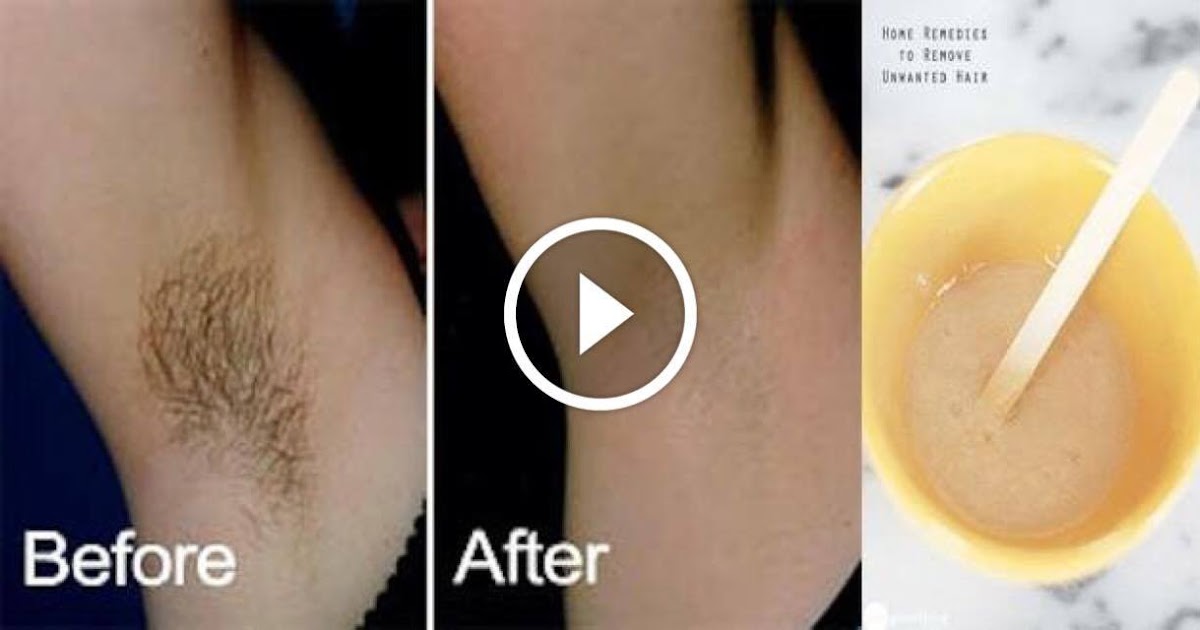 These 3 Simple Home Remedies Will Help Remove Underarm Hair Without Pain Viral Only