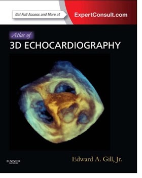Atlas of 3D Echocardiography