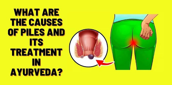 Best ayurvedic medicine for piles - Dr. Piles Free