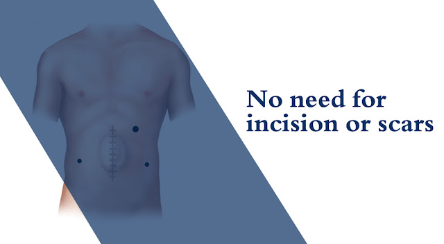 No need for incision or scars