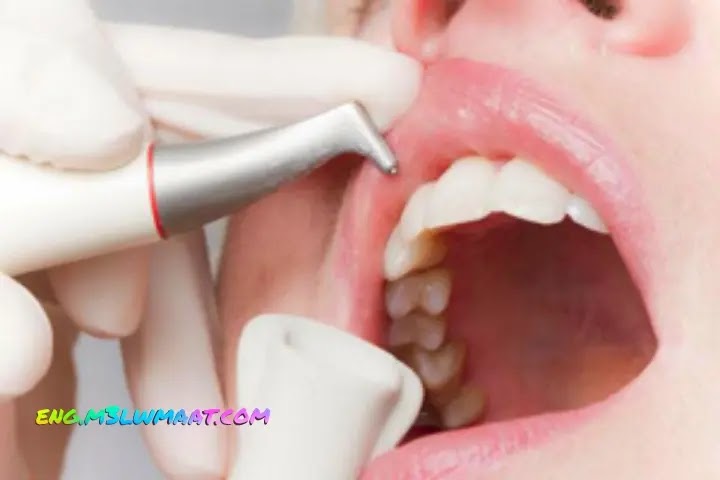 How to treat yellow teeth medically