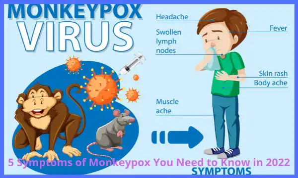 5 Symptoms of Monkeypox You Need to Know in 2022