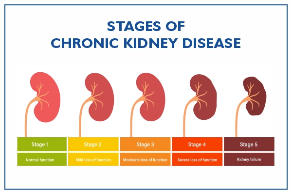 Renal Failure: causes,prevention and treatment