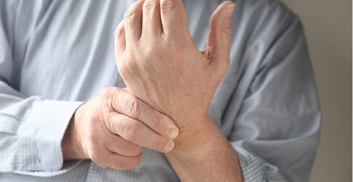 Study: Poor oral health linked to rheumatoid arthritis