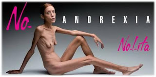 Isabelle Caro, Struggled Against Anorexia