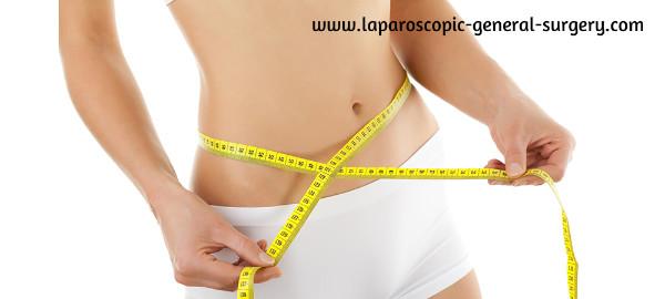 laparoscopic-general-surgery.com/bariatric-surgery/