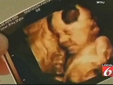 3d Sonogram4