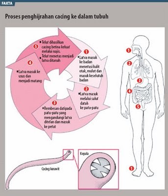 Poliklinik Bio-Sucinas: Jangkitan Cacing