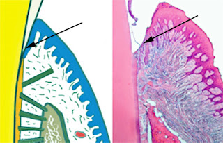 <Img src ="Dibujo_y_microfotografía_surco gingival.jpg" width = "600" height "387" border = "0" alt = "Dibujo de la anatomía del surco gingival.">